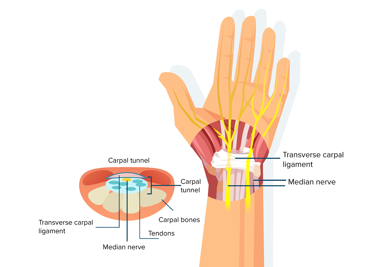 What is the carpal tunnel?